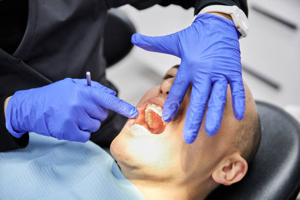 Best Broken or Cracked Tooth Emergency Dentist in Carolina Forest, SC