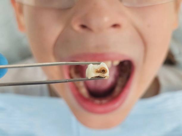 Best Orthodontic Emergency Dentist in Carolina Forest, SC